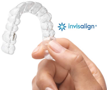 Private: Invisalign Teen: What You Need to Know