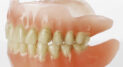 Private: Dental Implants: An Alternative to Dentures and Bridges